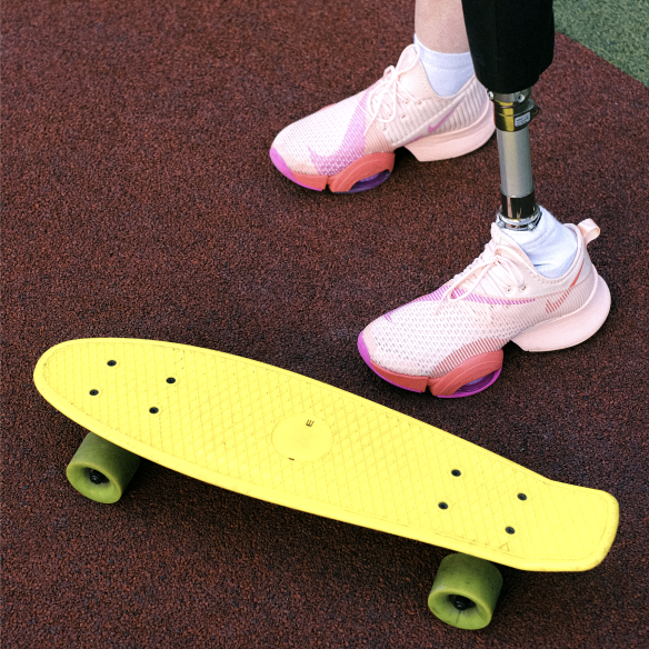 Planche de skateboard avec les jambes d'une personne dont l'une est avec une attelle